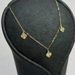 گردنی ونکلیف - تصویر 2