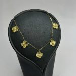 گردنی ونکلیف