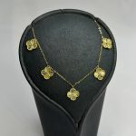 گردنی ونکلیف - تصویر 3